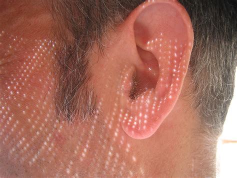Scientists Discover “hidden Hearing Loss” Morning Sign Out