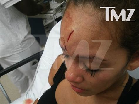 Evelyn Lozada Bloody Head Photos After Chad Johnson Assault Urban Islandz