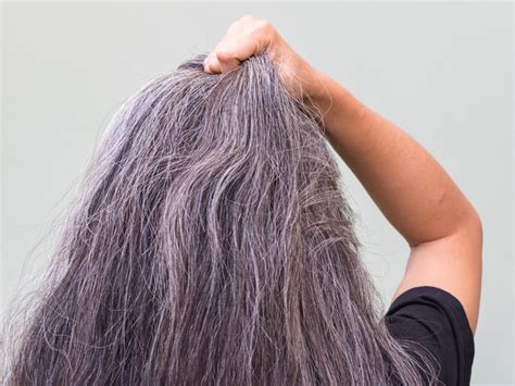Does Stress Cause Gray Hair It May Lead To Premature Graying
