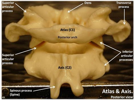 Atlas C1 And Axis C2 Vertebrae Posterior View With Labels Flickr