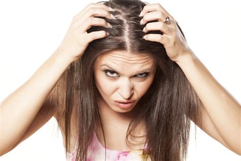 Dry Scalp Causes Symptoms Treatment 21 Home Remedies To Get Rid