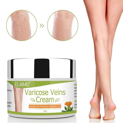 50ml Varicose Vein Ointment Remove Red Blood Streaks Varicosity Veins