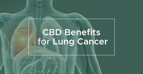 Cbd Benefits For Lung Cancer — We Are Canna — News
