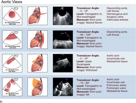 Transesophageal Echocardiography Thoracic Key