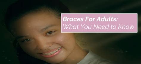What You Need To Know About Braces For Adults