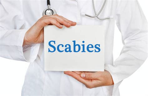 Scabies Stock Photos Pictures And Royalty Free Images Istock