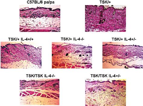 Histopathology Of The Skin From Mice Exhibiting Various Genotypes