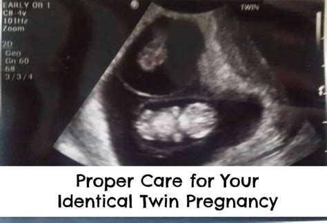 Proper Care For Your Identical Twin Pregnancy Pregnancy Months