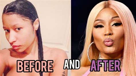 nicki minaj before and after transformation plastic surgery makeup and more youtube