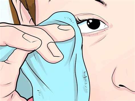 A johns hopkins expert provides perspective on bloating and gas cramps, including everyone gets gas on occasion. Get Rid Of a Stye | Treating a stye, Eye stye remedies ...