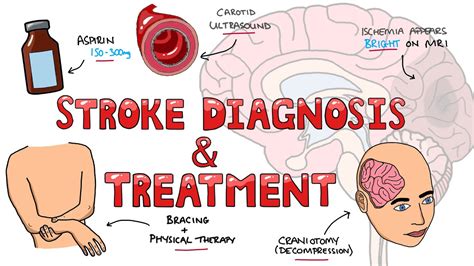 Management Of Stroke Patients Using The Team Based Learning Approach