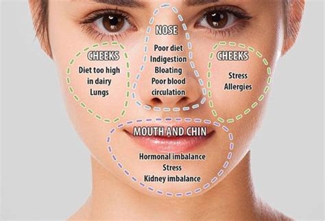 Chinese Face Mapping Skin Analysis The Whoot Face Mapping Health Health And Beauty Tips