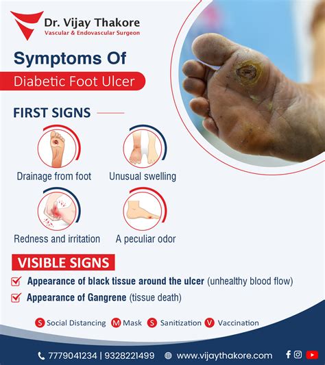 Diabetic Foot Ulcer Diabetic Foot Treatment Doctor In Vadodara Dr Vijay Thakore