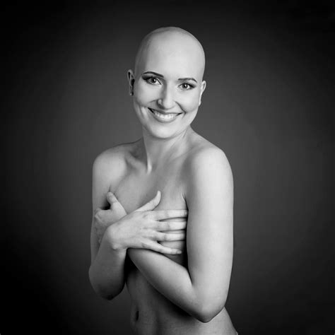 Susually, each hair follicle follows a life cycle. Alopecia areata - Hannah - Beate Knappe