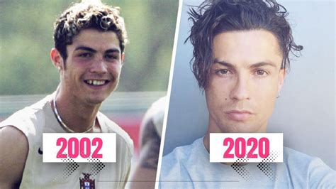 Cristiano Ronaldo Before And After Plastic Surgery Full Transformation Journey