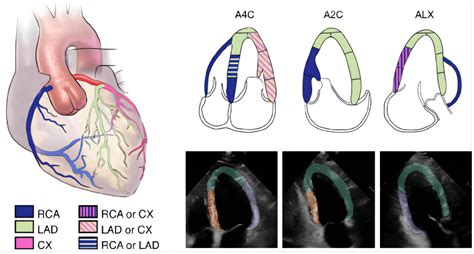 Frontiers Echocardiography Based AI Detection Of Regional Wall Motion
