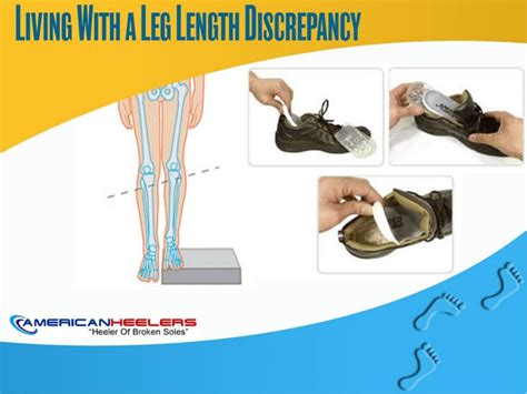 Living With A Leg Length Discrepancy Quad Muscles Runners Knee Legs