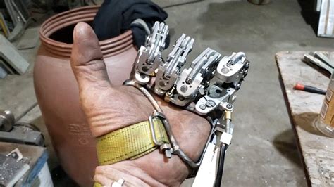 Amputee Builds A Remarkable Set Of Prosthetic Fingers
