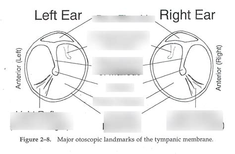 Tympanic Membrane Diagram Quizlet