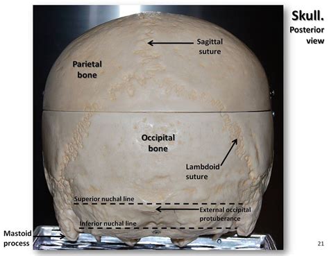 The skull bones can be classified into two groups: Skull, posterior view with labels - Axial Skeleton Visual … | Flickr