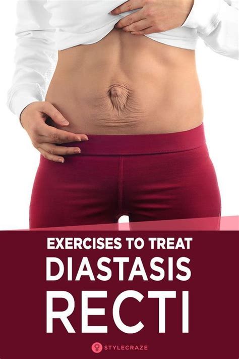 10 Exercises For Diastasis Recti That Strengthen Your Core Diastasis