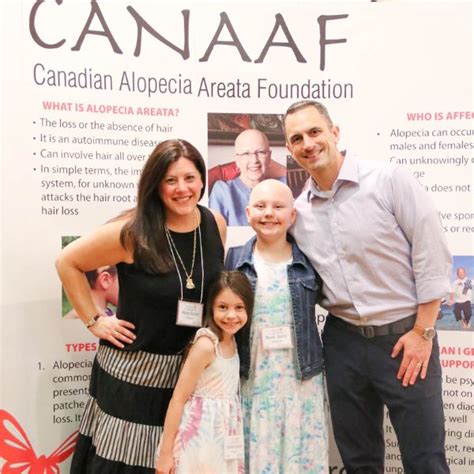 Fondation Canadienne De Lalopécie Areata Canaaf