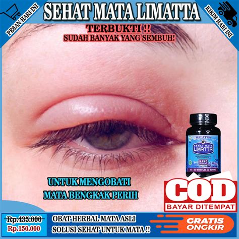 Jual Obat Mata Bengkak Perih Obat Mata Bintitan Pengempis Bengkak Di