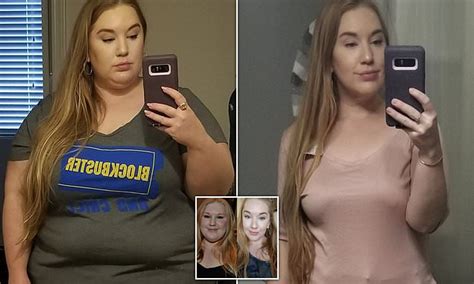 Obese Woman Who Ate Calories A Day Sheds Half Her Body Weight