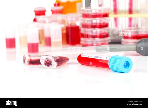Vacutainer Blood Tube Hi Res Stock Photography And Images Alamy