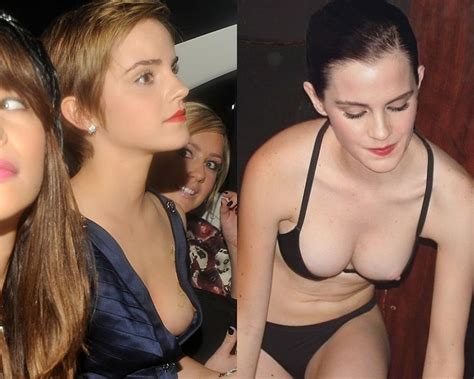 Emma Watson Nip Slips Emma Watson Nip Slips Image The Best Porn Website