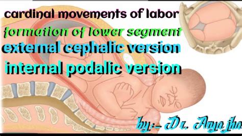 Cardinal Movement Of Labor Asynclitism Management Of Cephalic Breach Shoulder