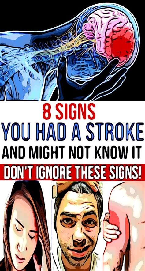 8 Signs You Had A Stroke And Might Not Know It Dont Ignore These