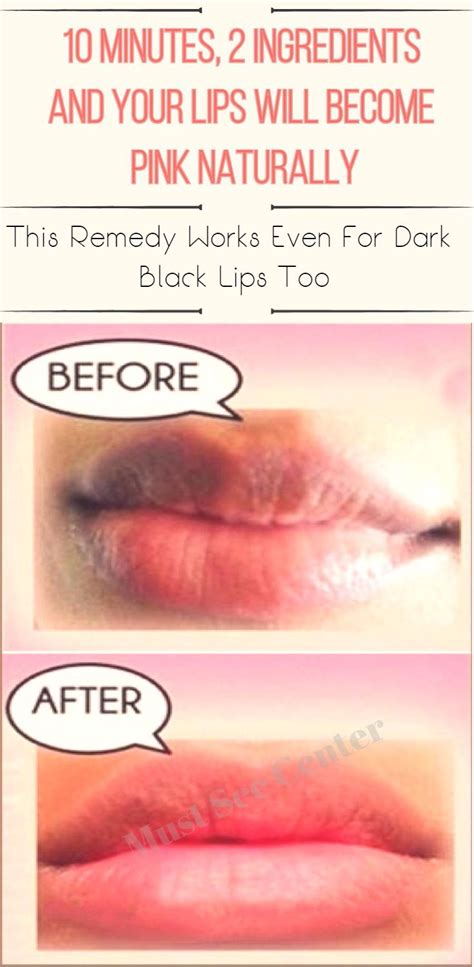How To Turn Your Lips From Black To Pink Essence Sims