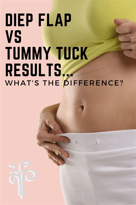 How To Qualify For Free Tummy Tuck Donella Hendrix