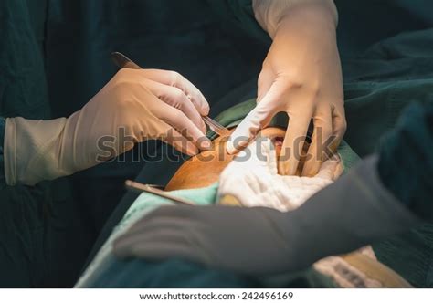 Surgeon Prepare Skin Incision Stock Photo 242496169 Shutterstock