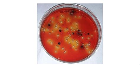 Growth Of Salmonella And Shigella On Xld Agar Download Scientific