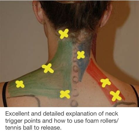 Neck Trigger Points Massage Therapy Trigger Points Muscles Massage