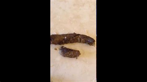 Tapeworms In My Dogs Poop Tenias En Las Heces De Mi Cachorro Youtube