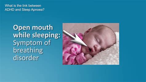 Sleep Apnea Symptoms In Infants