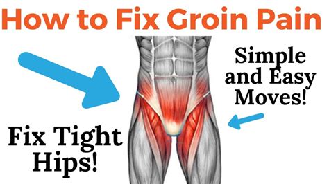 Groin Pain Radiating Down Inside Leg How To Fix Groin Hip Pain Tight Hip Flexor Youtube