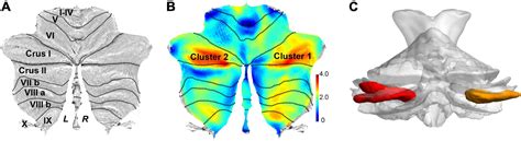 Frontiers Significant Structural Alterations And Functional