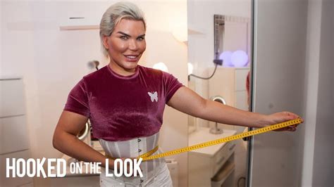 Rib Luxation Plastic Surgery Before And After Rodrigo Alves Has Four