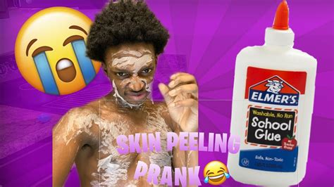 Skin Peeling Prank Hilarious Youtube