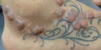 Pubg names, pubgm names, pubg mobile names: In Addition To Regret, Tattoos Can Pose Serious Health ...