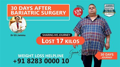 Bariatric Surgery In Punjab Days Journey Lost Kilos Jammu Hospital Jalandhar Youtube