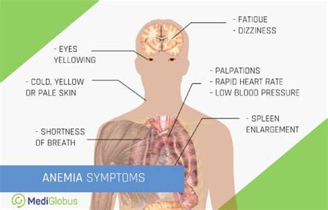 Fanconi Anemia Symptoms