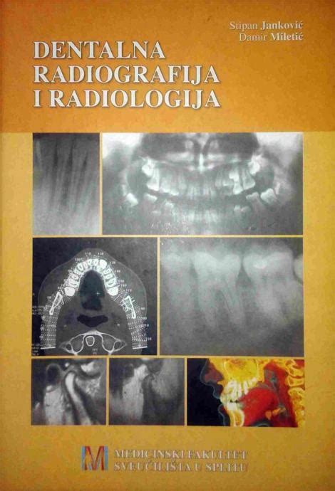 Dentalna Radiografija I Radiologija S Janković D Miletić