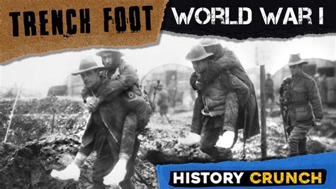 Trench Foot In World War 1 Video Infographic Youtube