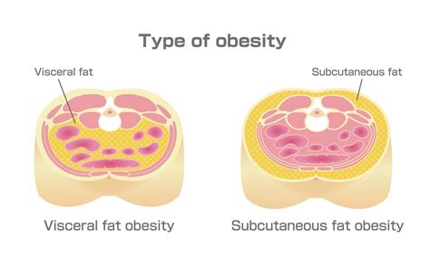 Visceral Fat Level Chart