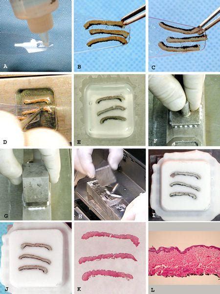 Cryosectioning Overview Protocol For Sectioning Frozen Tissue